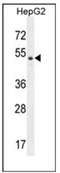 Western blot analysis of DPEP3 Antibody (C-term) in HepG2 cell line lysates (35ug/lane). This demonstrates the DPEP3 antibody detected the DPEP3 protein (arrow).