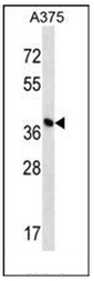 Western blot analysis of DPH1 / OVAC1 Antibody (C-term) in A375 cell line lysates (35ug/lane). This demonstrates the DPH1 antibody detected the DPH1 protein (arrow).