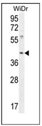 Western blot analysis of DUS4L Antibody in WiDr cell line lysates (35ug/lane). This demonstrates the DUS4L antibody detected the DUS4L protein (arrow).