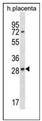 Western blot analysis of EAN57 / C22orf33 Antibody (N-term) in human placenta tissue lysates (35ug/lane). This demonstrates the EAN57 antibody detected the EAN57 protein (arrow).
