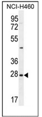 Western blot analysis of Endothelin-3 Antibody (C-term) Cat.-NoAP51366PU-Nin NCI-H460 cell line lysates (35ug/lane). This demonstrates the EDN3 antibody detected the EDN3 protein (arrow). Western blot analysis of Endothelin-3 Antibody (C-term) Cat.-NoAP51366PU-Nin NCI-H460 cell line lysates (35ug/lane). This demonstrates the EDN3 antibody detected the EDN3 protein (arrow).