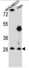 TA302875 staining (0.5ug/ml) of Human Bone Marrow lysate (RIPA buffer, 35ug total protein per lane). Primary incubated for 1 hour. Detected by western blot using chemiluminescence.