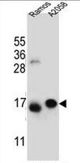 EIF5AL1 Antibody (C-term) western blot analysis in Ramos, A2058 cell line lysates (35ug/lane).This demonstrates the EIF5AL1 antibody detected the EIF5AL1 protein (arrow).