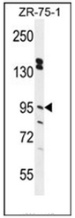 Western blot analysis of ERMP1 Antibody (C-term) in ZR-75-1 cell line lysates (35ug/lane). This demonstrates the ERMP1 antibody detected the ERMP1 protein (arrow).