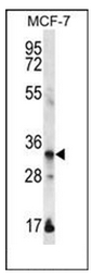 Western blot analysis of EVPLL Antibody (Center) in MCF-7 cell line lysates (35ug/lane). This demonstrates the EVPLL antibody detected the EVPLL protein (arrow).