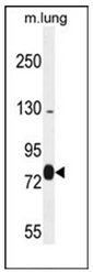 Western blot analysis of EXOC8 Antibody (Center) in mouse lung tissue lysates (35ug/lane). This demonstrates the EXOC8 antibody detected the EXOC8 protein (arrow).