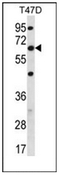 Western blot analysis of FAM83D Antibody (C-term) in T47D cell line lysates (35ug/lane). This demonstrates the FAM83D antibody detected the FAM83D protein (arrow). Western blot analysis of FAM83D Antibody (C-term) in T47D cell line lysates (35ug/lane). This demonstrates the FAM83D antibody detected the FAM83D protein (arrow).