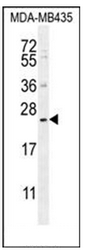 Western blot analysis of FAM109A Antibody (N-term) in MDA-MB435 cell line lysates (35ug/lane). This demonstrates the FAM109A antibody detected the FAM109A protein (arrow).