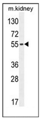 Western blot analysis of FBXO39 Antibody (C-term) in mouse kidney tissue lysates (35ug/lane). This demonstrates the FBXO39 antibody detected the FBXO39 protein (arrow).