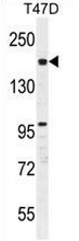 Western blot analysis in T47D cell line lysates (35ug/lane) using FHAD1 antibody. (C-term). This demonstrates the FHAD1 antibody detected the FHAD1 protein (arrow).