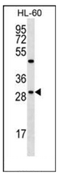 Western blot analysis of FMR1NB Antibody (N-term) in HL-60 cell line lysates (35ug/lane). This demonstrates the FMR1NB antibody detected the FMR1NB protein (arrow).