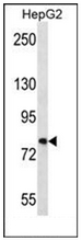 Western blot analysis of FNDC7 Antibody (C-term) in HepG2 cell line lysates (35ug/lane). This demonstrates the FNDC7 antibody detected the FNDC7 protein (arrow).