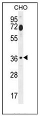 TA303043 staining (0.3ug/ml) of Hela lysate (RIPA buffer, 30ug total protein per lane). Primary incubated for 1 hour. Detected by western blot using chemiluminescence.