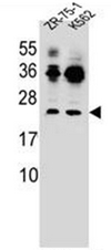 Western blot analysis of FRAT2 Antibody (C-term) in ZR-75-1, K562 cell line lysates (35ug/lane). This demonstrates the FRAT2 antibody detected the FRAT2 protein (arrow).