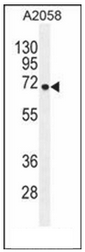 Western blot analysis of GAB4 Antibody (N-term) in A2058 cell line lysates (35ug/lane). This demonstrates the GAB4 antibody detected the GAB4 protein (arrow)