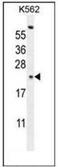 Western blot analysis of GAGE13 Antibody (N-term) Cat.-No AP51758PU-Nin K562 cell line lysates (35ug/lane). This demonstrates the GAGE13 antibody detected the GAGE13 protein (arrow).