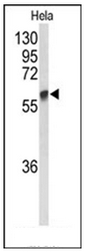 Western blot analysis of GALNT2 Antibody (N-term) in Hela cell line lysates (35ug/lane). GALNT2 (arrow) was detected using the purified Pab.