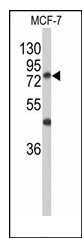 Western blot analysis of GALNT3 Antibody (Center) in MCF-7 cell line lysates (35ug/lane). GALNT3 (arrow) was detected using the purified Pab.