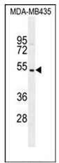 Western blot analysis of GFRAL Antibody (C-term) in MDA-MB435 cell line lysates (35ug/lane). This demonstrates the GFRAL antibody detected the GFRAL protein (arrow).