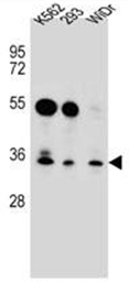 Western blot analysis of GLIPR1L2 Antibody (N-term) in K562, 293, WiDr cell line lysates (35ug/lane). This demonstrates the GLIPR1L2 antibody detected the GLIPR1L2 protein (arrow).