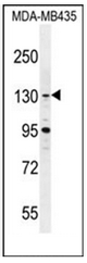 Western blot analysis of GLTSCR1 Antibody (Center) in MDA-MB435 cell line lysates (35ug/lane). This demonstrates the GLTSCR1 antibody detected the GLTSCR1 protein (arrow).