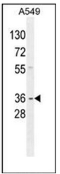 Western blot analysis of GNAT3 Antibody (Center) in A549 cell line lysates (35ug/lane). This demonstrates the GNAT3 antibody detected the GNAT3 protein (arrow).