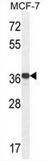 GPD1L Antibody (N-term) western blot analysis in MCF-7 cell line lysates (35ug/lane).This demonstrates the GPD1L antibody detected the GPD1L protein (arrow).