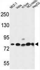 GPHN Antibody (Center) western blot analysis in MCF-7, Hela, NCI-H460, HepG2 cell line and mouse liver tissue lysates (35ug/lane).This demonstrates the GPHN antibody detected the GPHN protein (arrow).