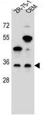 GPM6B Antibody (N-term) western blot analysis in ZR-75-1, CEM cell line lysates (35ug/lane).This demonstrates the GPM6B antibody detected the GPM6B protein (arrow).