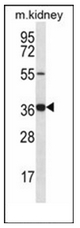 Western blot analysis of GRXCR1 Antibody (Center) in mouse kidney tissue lysates (35ug/lane). This demonstrates the GRXCR1 antibody detected the GRXCR1 protein (arrow). Western blot analysis of GRXCR1 Antibody (Center) in mouse kidney tissue lysates (35ug/lane). This demonstrates the GRXCR1 antibody detected the GRXCR1 protein (arrow).