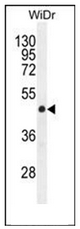 Western blot analysis of Gasdermin C Antibody (Center) in WiDr cell line lysates (35ug/lane). This demonstrates the GSDMC antibody detected the GSDMC protein (arrow).