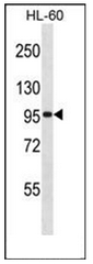 Western blot analysis of GTF3C2 / TFIIIC110 Antibody (N-term) in HL-60 cell line lysates (35ug/lane). This demonstrates the GTF3C2 antibody detected the GTF3C2 protein (arrow).