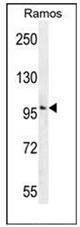 Western blot analysis of GUCY2D / GUCY2D / RETGC1 Antibody (Center).-No in Ramos cell line lysates (35ug/lane).This demonstrates the GUCY2D antibody detected the GUCY2D protein (arrow).
