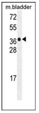 Western blot analysis of HARB1 Antibody (N-term) in mouse bladder tissue lysates (35ug/lane). This demonstrates the HARB1 antibody detected the HARB1 protein (arrow).