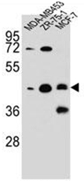Western blot analysis of hCG_1645727 Antibody (C-term) in MDA-MB453, ZR-75-1, MCF-7 cell line lysates (35ug/lane). This demonstrates the hCG_1645727 antibody detected the hCG_1645727 protein (arrow).