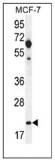 Western blot analysis of hCG_1646420 Antibody (Center) in MCF-7 cell line lysates (35ug/lane). This demonstrates the hCG_1646420 antibody detected the hCG_1646420 protein (arrow).