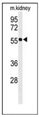 Western blot analysis of HIAT1 Antibody (C-term) in mouse kidney tissue lysates (35ug/lane). HIAT1 (arrow) was detected using the purified Pab.