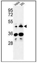 Western blot analysis of HS3ST2 Antibody (C-term) in Hela, 293 cell line lysates (35ug/lane). HS3ST2 (arrow) was detected using the purified Pab.