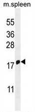 IFITM5 Antibody (Center) western blot analysis in mouse spleen tissue lysates (35ug/lane).This demonstrates the IFITM5 antibody detected the IFITM5 protein (arrow).