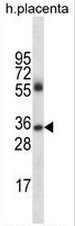IGHG4 Antibody (Center) (Cat. #AP52171PU-N) western blot analysis in human placenta tissue lysates (35g/lane).This demonstrates the IGHG4 antibody detected the IGHG4 protein (arrow)</span>