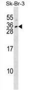 Western blot analysis in SK-BR-3 cell line lysates (35ug/lane) using Interleukin-28B antibody. (N-term). This demonstrates the Interleukin-28B antibody detected the Interleukin-28B protein (arrow).