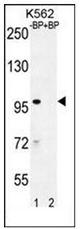 Western blot analysis of IQCA1 Antibody (C-term) pre-incubated without (lane 1) and with (lane 2) blocking peptide in K562 cell line lysate. IQCA1 Antibody (C-term) (arrow) was detected using the purified Pab (1:60/250 dilution).