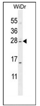 Western blot analysis of IQCF1 Antibody (N-term) in WiDr cell line lysates (35ug/lane). This demonstrates the IQCF1 antibody detected the IQCF1 protein (arrow). Western blot analysis of IQCF1 Antibody (N-term) in WiDr cell line lysates (35ug/lane). This demonstrates the IQCF1 antibody detected the IQCF1 protein (arrow).