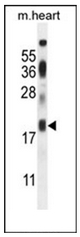 Western blot analysis of ISCA2 / HBLD1 Antibody (Center) in mouse heart tissue lysates (35ug/lane).
