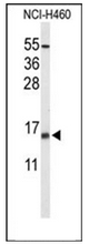 Western blot analysis of KCE1L Antibody (Center) in NCI-H460 cell line lysates (35ug/lane). KCE1L (arrow) was detected using the purified Pab.