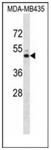 Western blot analysis of KCNJ13 Antibody (N-term) in MDA-MB435 cell line lysates (35ug/lane). This demonstrates the KCNJ13 antibody detected the KCNJ13 protein (arrow).