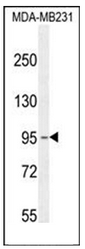 Western blot analysis of KCNT2 / SLICK Antibody (C-term) in MDA-MB231 cell line lysates (35ug/lane). This demonstrates the KCNT2 antibody detected the KCNT2 protein (arrow).