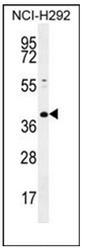 Western blot analysis of KCTD2 Antibody (C-term) in NCI-H292 cell line lysates (35ug/lane). This demonstrates the KCTD2 antibody detected the KCTD2 protein (arrow).