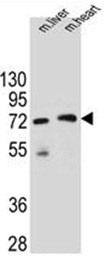 Western blot analysis of KCTD8 Antibody (C-term) in mouse liver and heart tissue lysates (35ug/lane). This demonstrates the KCTD8 antibody detected the KCTD8 protein (arrow).