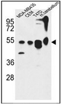 Western blot analysis of KIAA0652 Antibody (N-term) in MDA-MB435, CEM, 47D cell line and mouse cerebellum tissue lysates (35ug/lane).